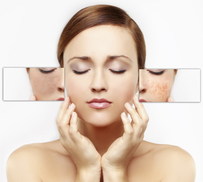 Treatment for problematic skin